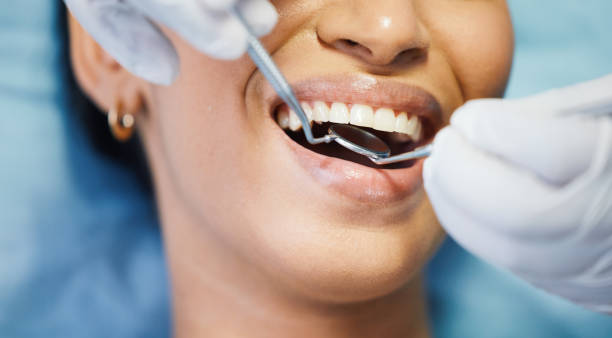 Best Walk-In Emergency Dentist in Marble Hill, MO